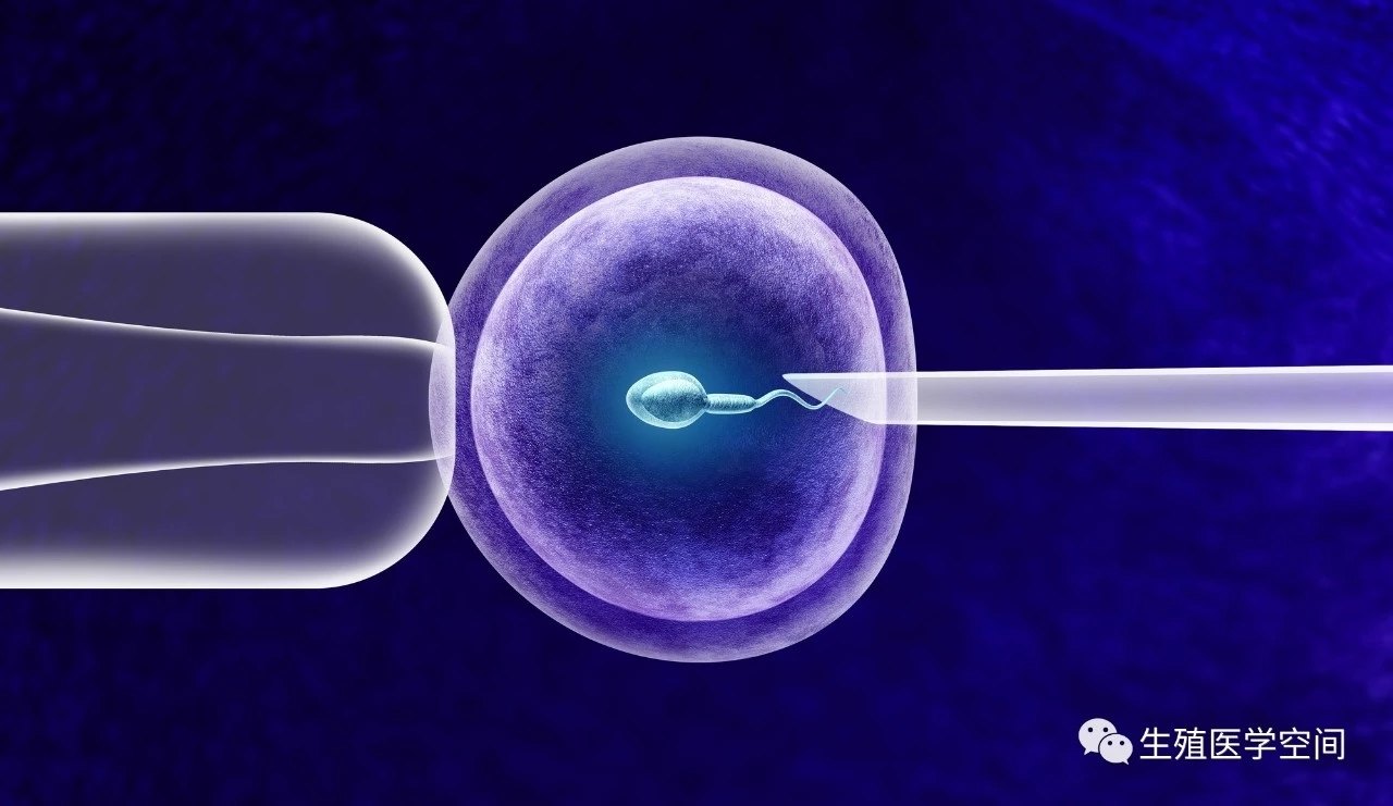 试管婴儿移植后工作时间探讨
