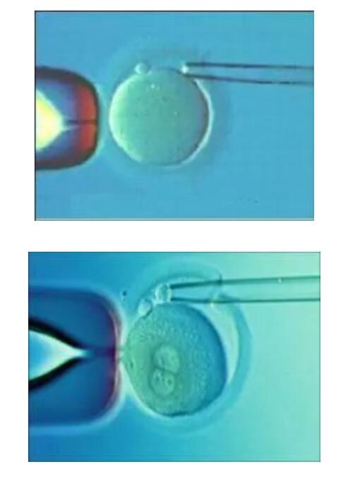 试管婴儿胚胎培养液优化策略