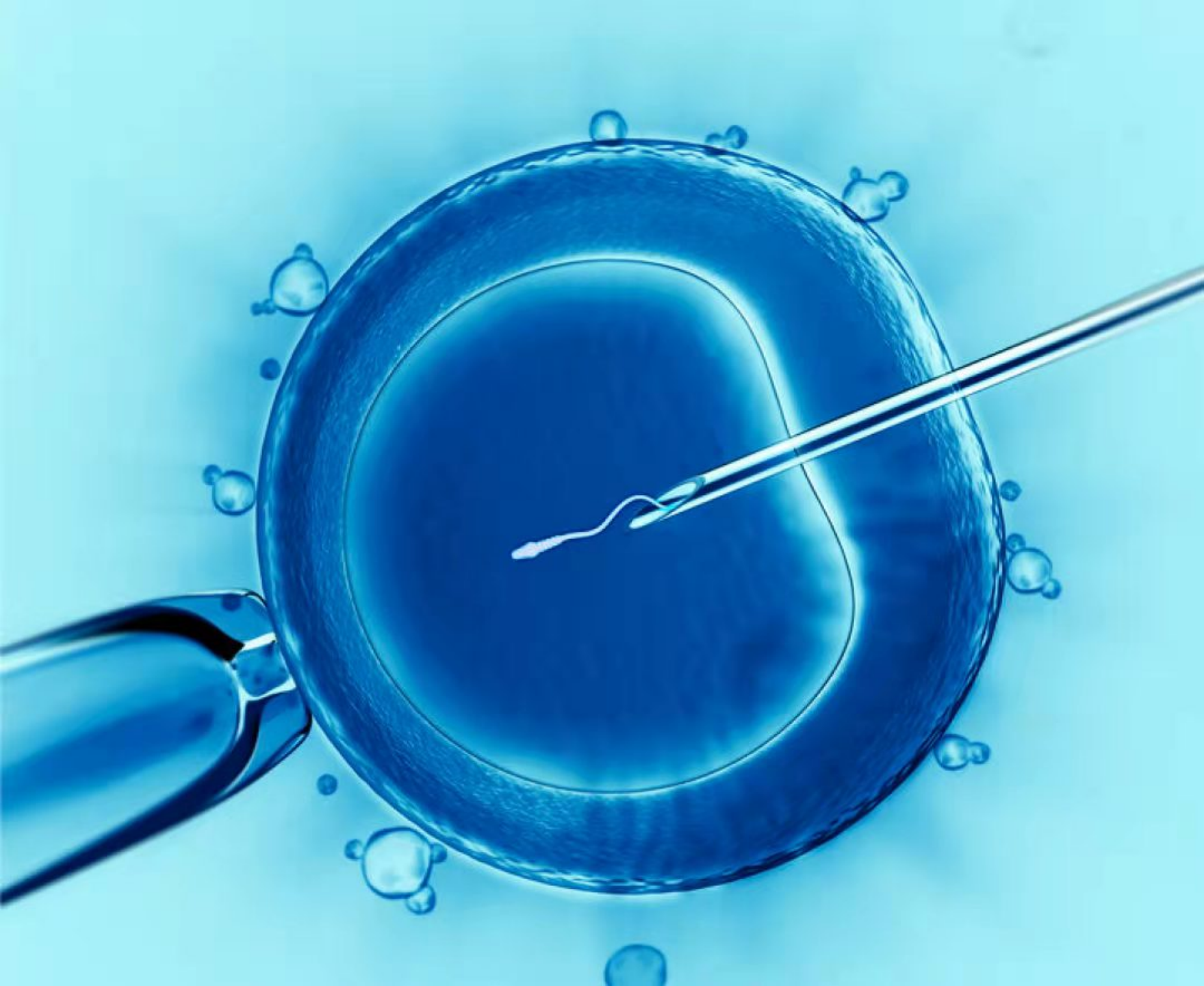 试管婴儿移植术后疼痛评估