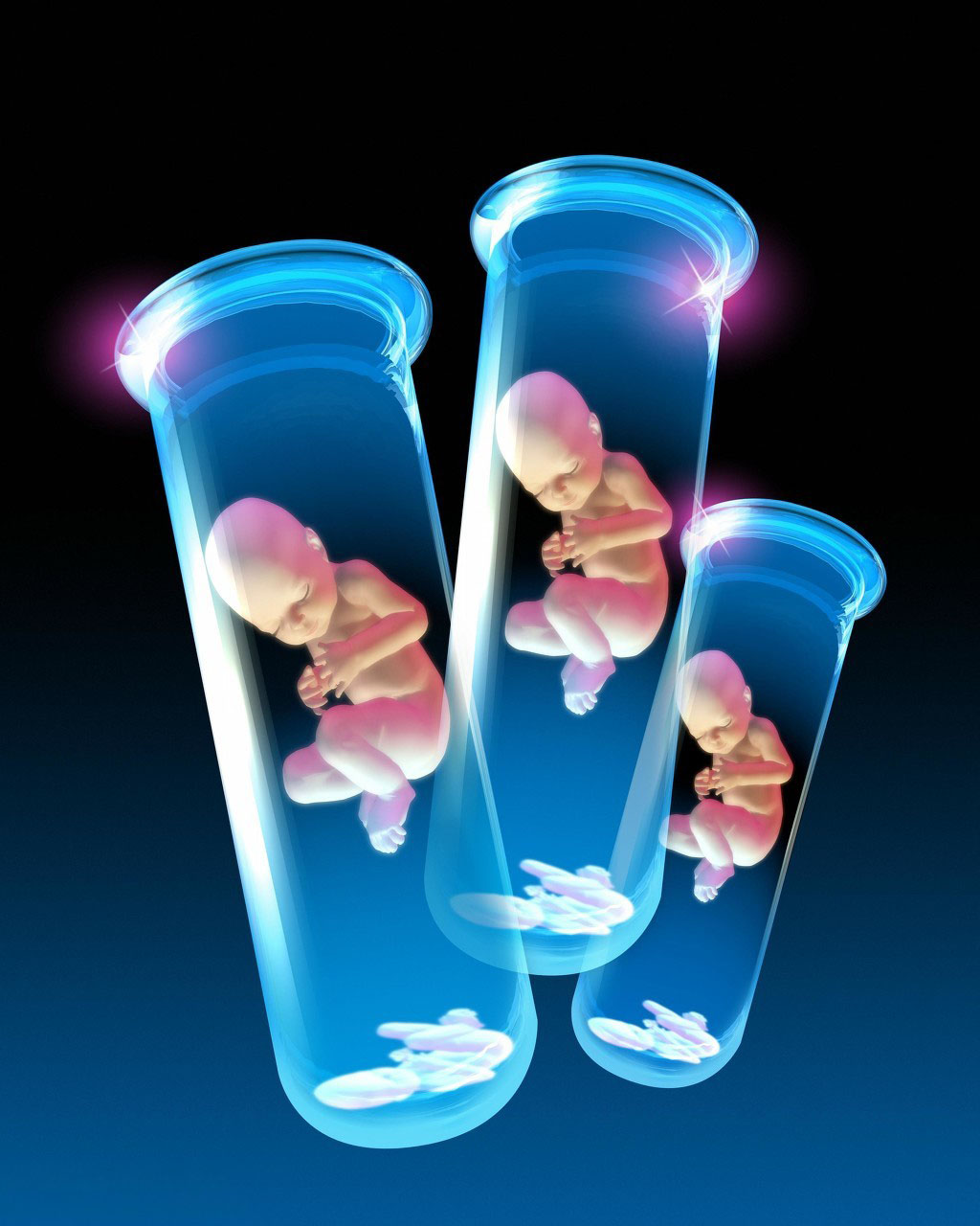 试管婴儿移植后情绪波动对妊娠结局的影响