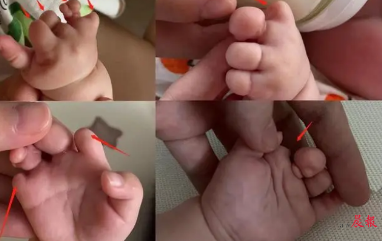 试管婴儿胚胎发育过程